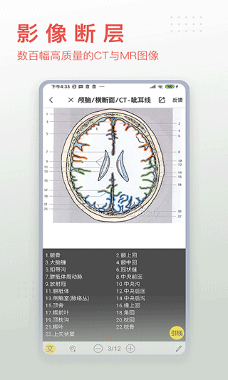 3dbody解剖截图