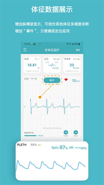 多体征监护仪截图